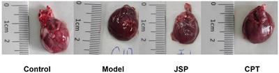 Combined analysis of plasma metabolome and intestinal microbiome sequencing to explore jiashen prescription and its potential role in changing intestine–heart axis and effect on chronic heart failure